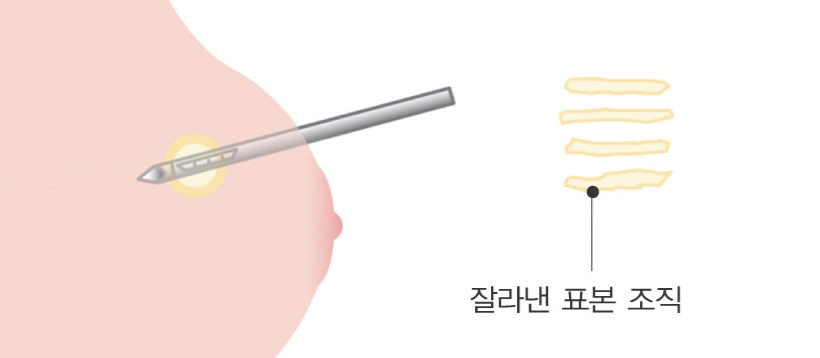 ������ �����˻� ���