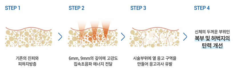 ���� �ü� ����